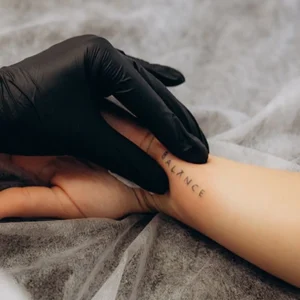 Picoláser - Eliminación de tatuajes