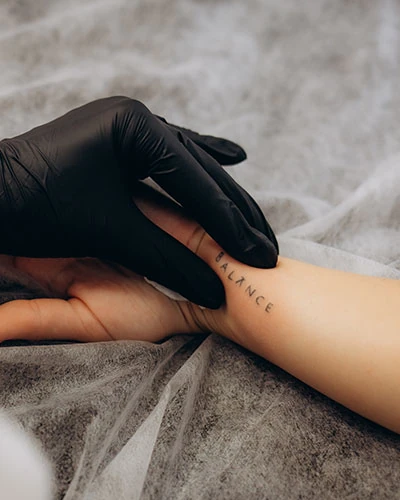 Imagen de eliminación de tatuajes con Picoláser en Patricia Osorio's Beauty