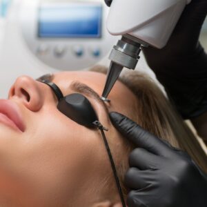 Imagen de tratamiento de Picoláser para la eliminación de micropigmentación de cejas en Patricia Osorio's Beauty
