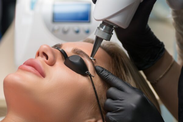 Imagen de tratamiento de Picoláser para la eliminación de micropigmentación de cejas en Patricia Osorio's Beauty