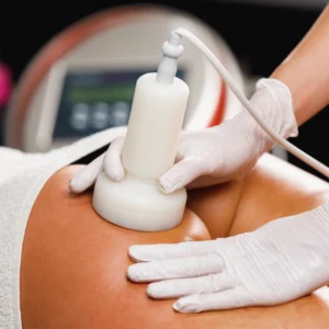 Imagen de cavitación en Patricia Osorio's Beauty