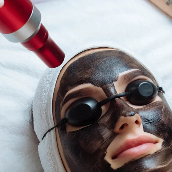 Imagen de tratamiento facial peeling hollywood en Patricia Osorio's Beauty