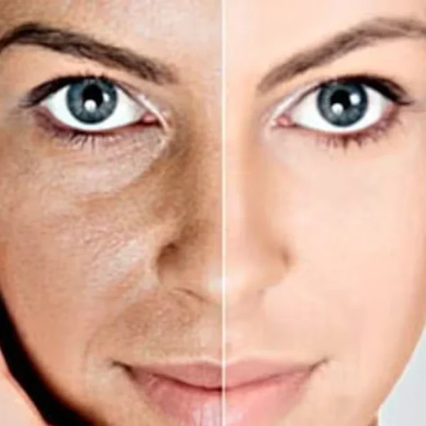 Imagen de tratamiento de rejuvenecimiento facial en Patricia Osorio's Beauty