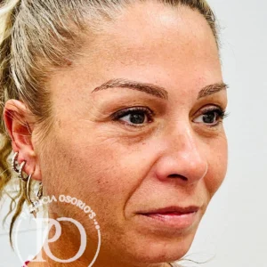 Imagen de tratamiento de microblading en Patricia Osorio Beauty